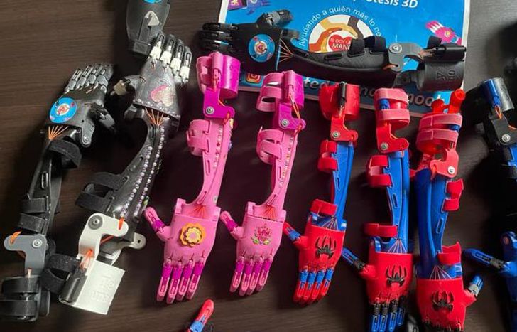 Las prótesis ortopédicas se fabrican con impresoras 3D.