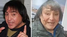 Ricky, tras las supuestas cirugías.