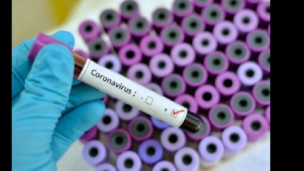 la campaña apunta a poder hacer frente al virus cuando llegue el pico de la pandemia.