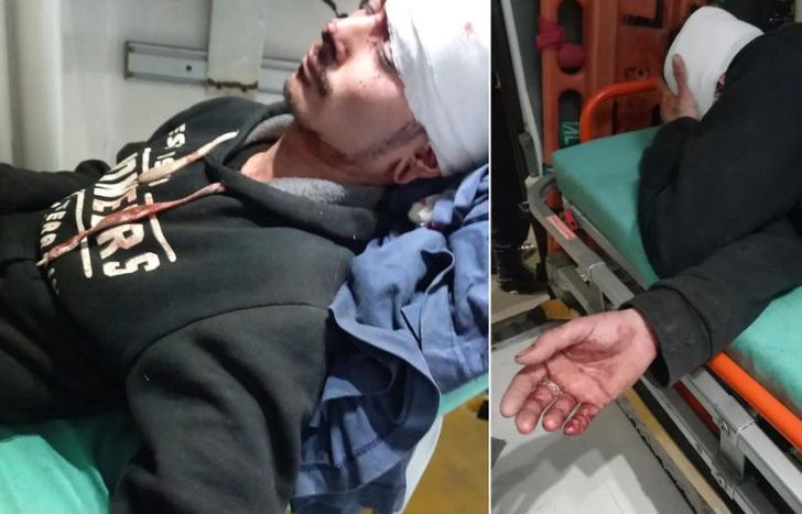 El joven atacado se recupera de las graves heridas.