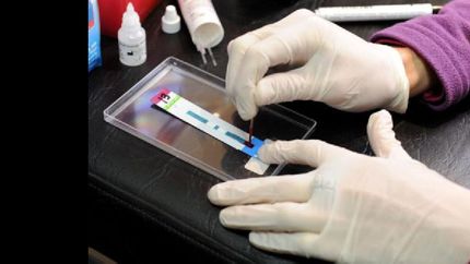 logran curar a un paciente con vih por segunda vez en la historia