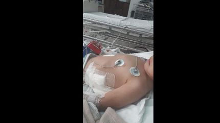 un nene fue atacado por dos dogos y un pitbull: quedo en terapia