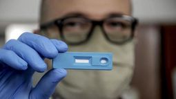 Farmacov, el test argentino para la detección rápida del Covid.