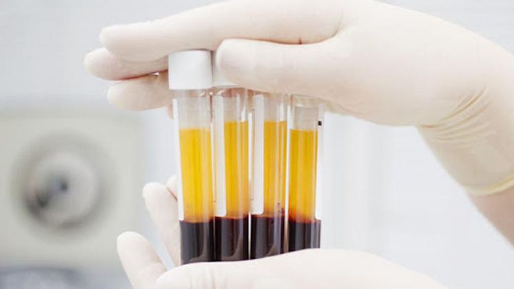 Relanzan plan de donación de plasma en Provincia de Buenos Aires.