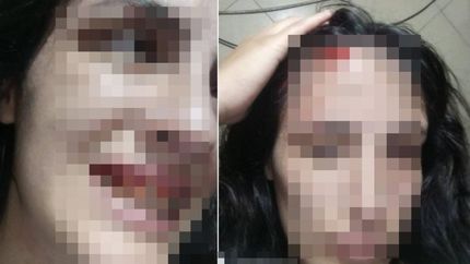 La joven atacada fue asistida por personal del SAME.