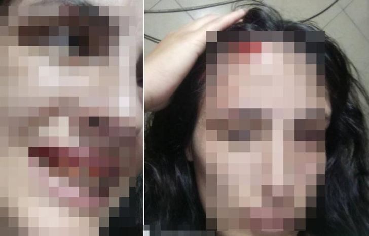 La joven atacada fue asistida por personal del SAME.