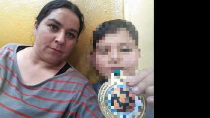 Fue quemada por su expareja. Fue quemada por su expareja.