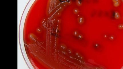 La bacteria encendió una alerta epidemiológica.