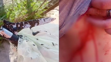 El arma con el que acuchillaron a la víctima y la profunda herida que le causaron.