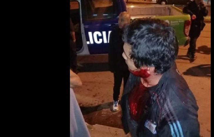 Uno de los pasajeros herido.