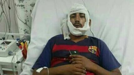El joven ya fue dado de alta, pero deberá operarse.
