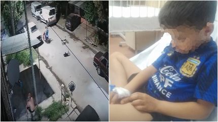 El nene atropellado se recupera de las heridas por el fuerte golpe. El nene atropellado se recupera de las heridas por el fuerte golpe.