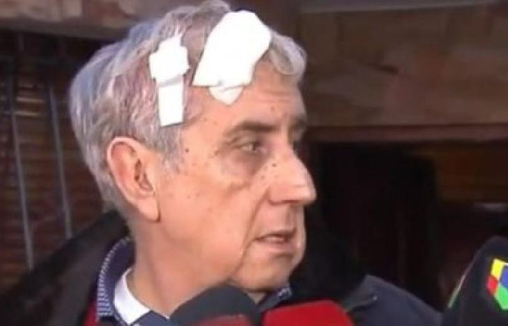 lo golpearon con la culata del arma en la cabeza.