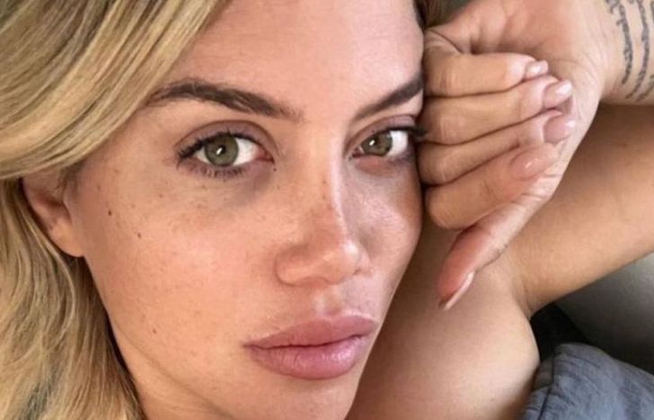 Wanda Nara está en pleno tratamiento.