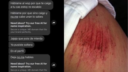 Las marcas de los golpes y amenazas a la víctima.