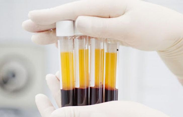 Relanzan plan de donación de plasma en Provincia de Buenos Aires.