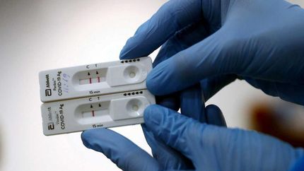 El Gobierno defendió la compra de los test de antígenos.