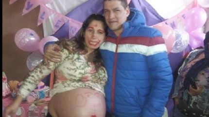 el ministerio de salud afirmo que la mujer de glew estaba embarazada de un solo bebe