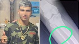 La hermana de Joaquín Castillo recibió cuatro disparos. La hermana de Joaquín Castillo recibió cuatro disparos.