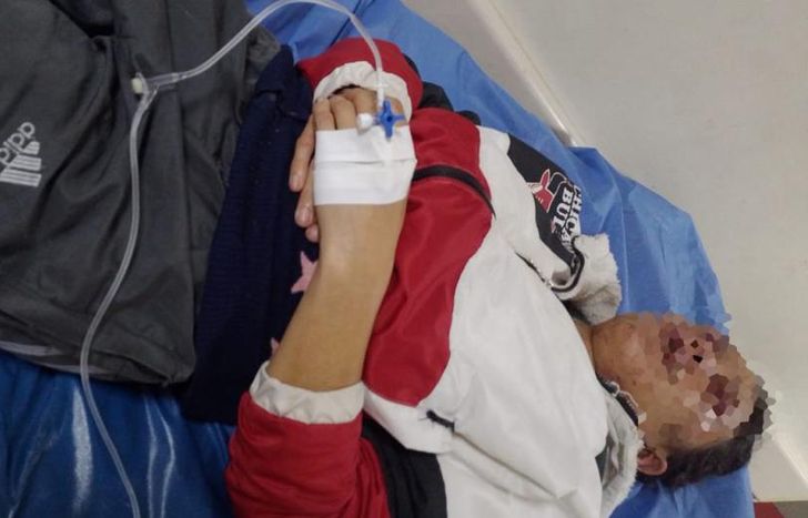 La víctima presentaba lesiones en diferentes partes del cuerpo.
