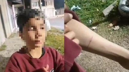 lomas: un nene se escapo de un hogar de ninos y denuncio que sufre maltrato