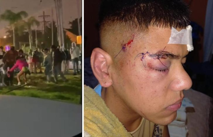 El joven lomense recibió varios puntos de sutura por la salvaje agresión.