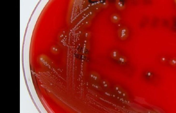 La bacteria encendió una alerta epidemiológica.