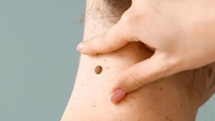 Una buena alternativa para atenderse en verano.