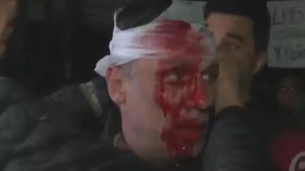 Cristian Mercatante, herido en un acto de Milei.