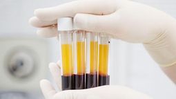 Relanzan plan de donación de plasma en Provincia de Buenos Aires.
