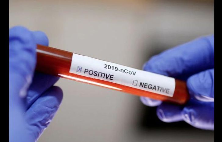 Es el segundo fallecido en Mar del Plata por la pandemia.