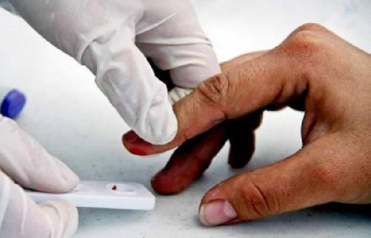 test hiv