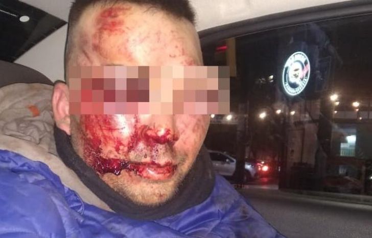 Lo lincharon brutalmente.