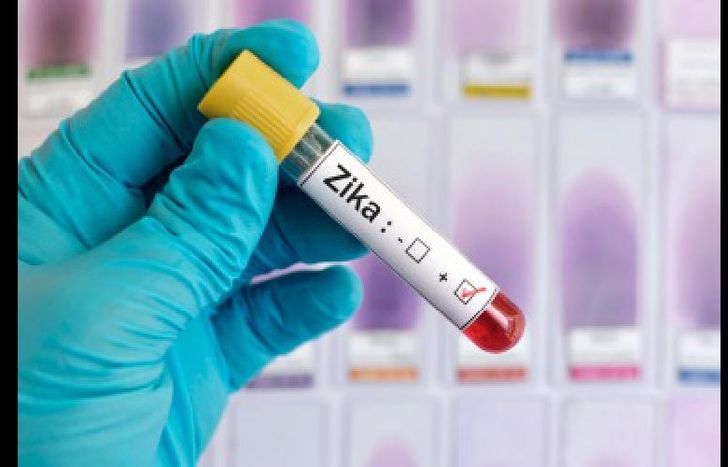 zika 4