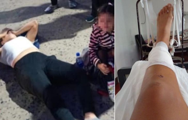 La menor no sufrió ninguna lesión, pero la mujer tuvo una fractura expuesta.