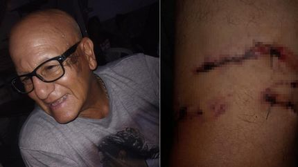 Gregorio antes del ataque y la herida que le quedó en su pierna.