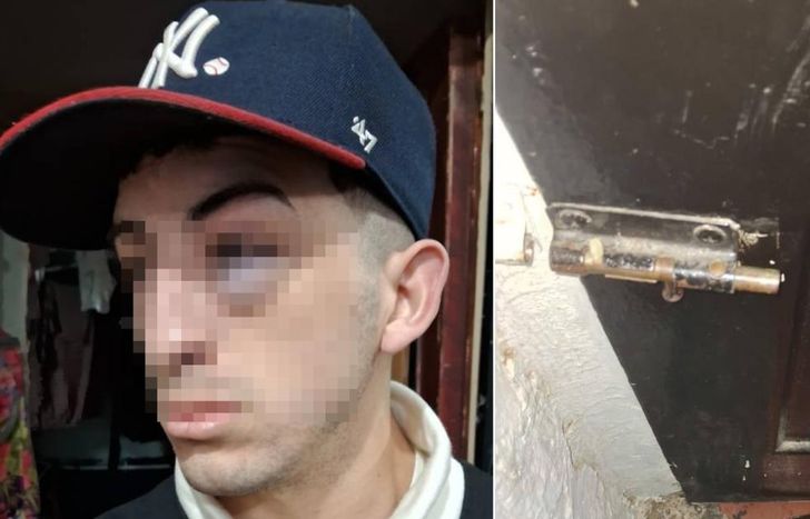 Las marcas de los golpes en la víctima y los daños en la propiedad.