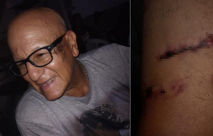 Gregorio antes del ataque y la herida que le quedó en su pierna.