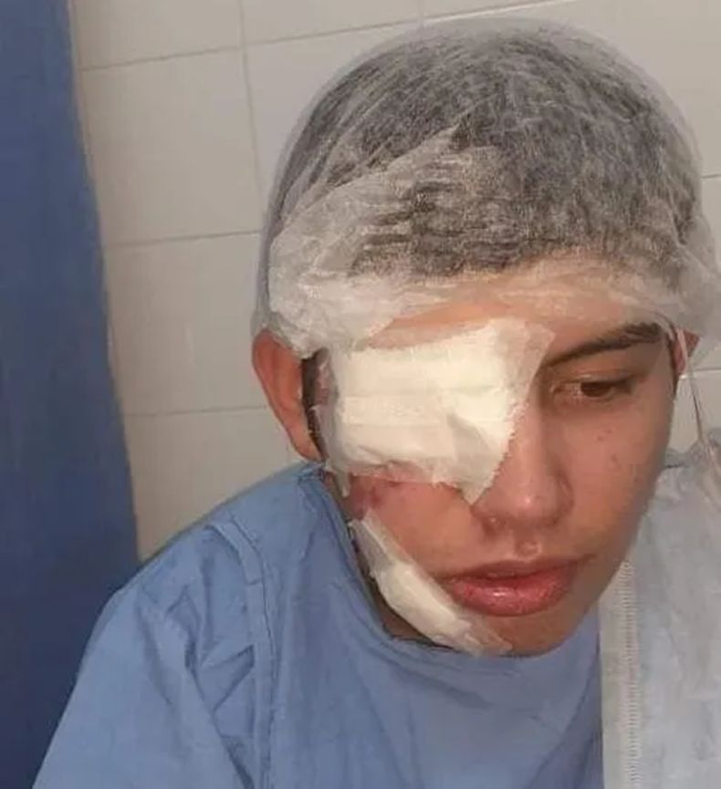Ignacio Seijas perdi&oacute; un ojo durante el operativo policial en Villa Centenario.