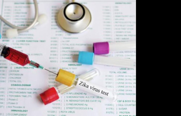 zika test