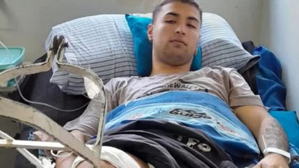Diario La Unión | Geronimo tuvo que ser operado y su recuperación requirió una prótesis.