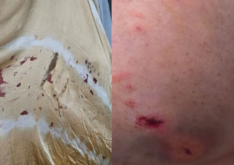 Andrea Taboada fue atacada por un perro. 