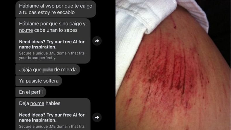 Las amenazas que recibió la mujer agredida en Lomas de Zamora.