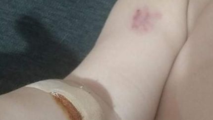 Así quedó el pequeño.