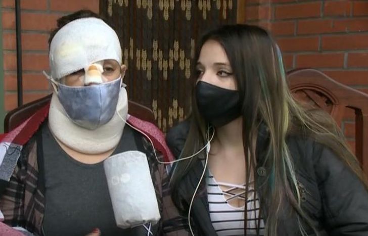 Natalia tiene golpes en la cabeza, la nariz y sufre desmayos.