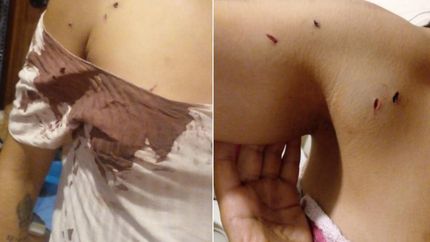 La joven atacada terminó ensangrentada, con golpes en distintas partes del cuerpo.