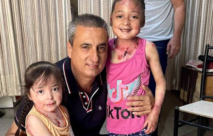 Colaboraron con las hermanas con piel de cristal.