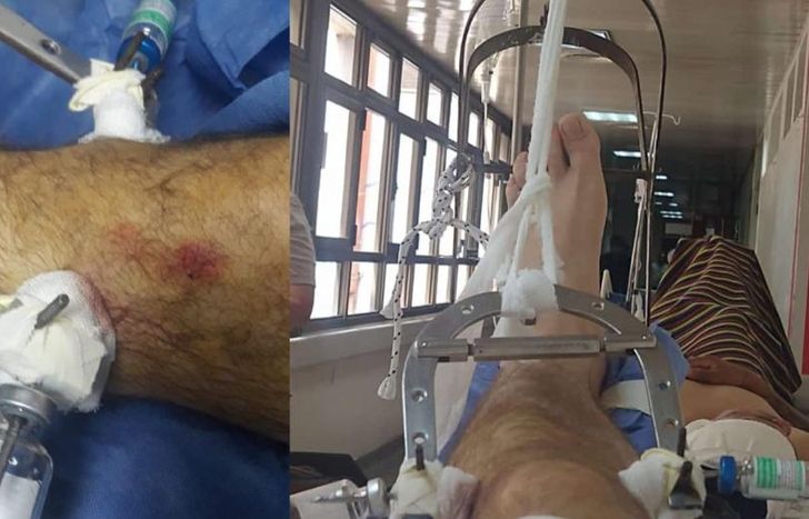 Sufrió graves politraumatismos.