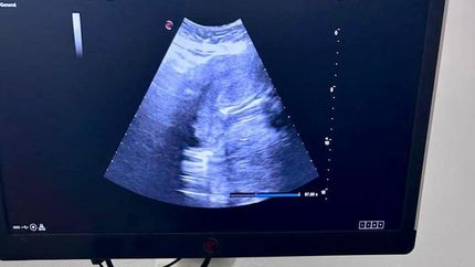 El ecógrafo de alta tecnología ya funciona en el Hospital Materno Infantil Alende de Budge.
