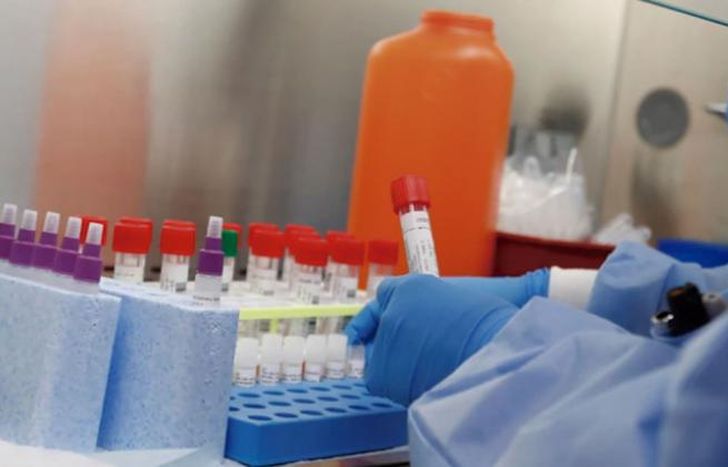 Aún están cursando la enfermedad 314.159 pacientes.